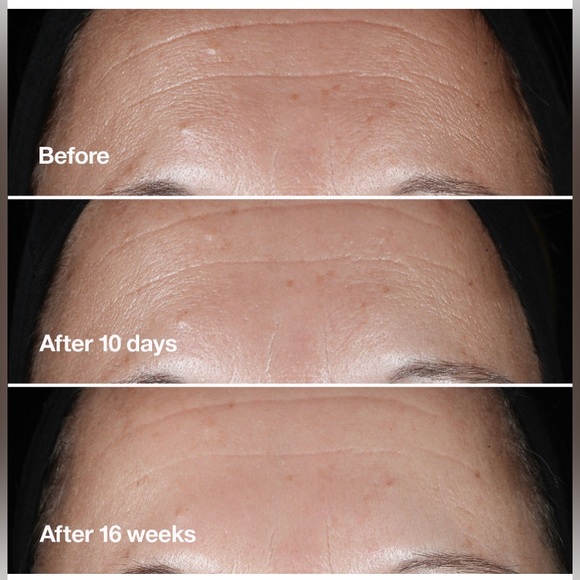 π2/$28 or 3/$38π NEW Clinique Smart Clinical Repair (Wrinkle Correcting Serum) - Picture 5 of 10